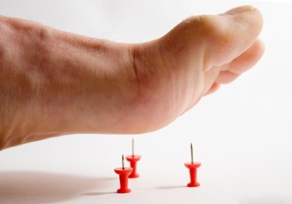 Neuropatia diabetică a simptomelor membrelor inferioare, tratament, metode de diagnostic, (neuropatie diabetică a membrelor inferioare simptome diagnosticarea precoce a tratamentului de prevenire a prognosticului tarziu) Neuropatia diabetică a membrelor inferioare simptome, tratament, metode de diagnostic,