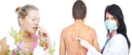 alergii Enterosgel de instruire, lecturi, comentarii (mărturie) Enterosgel alergii de instruire, lecturi, comentarii