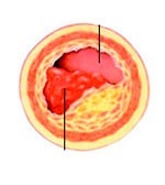 Flebologia Moscova, tratamentul varicelor în centrul Moscova mupf angio intrare clinici Flebologie (centru) Flebologia Moscova, tratamentul varicelor în centrul Moscova mupf angio intrare clinici flebologie