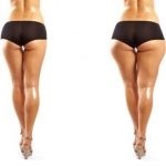 Bridji în șolduri ca un masaj curat si exercitii fizice, dieta și video (pantaloni) Bridguri în șolduri ca un masaj curat si exercitii fizice, dieta și video