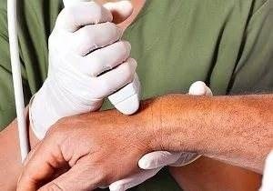 Higroma ce este, simptomele sale si metodele de tratament (simptome higroma de tratament traume tumorale perie picior dureri de umăr cu laser în comun) Higroma ce este, simptomele și tratamentele