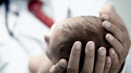 encefalopatie hipoxic ischemică (encefalopatie) Hipoxic-ischemică encefalopatie