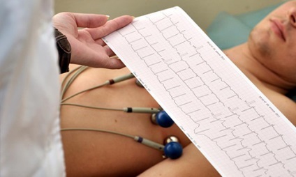 Cum să trișeze ECG (efort excesiv) Cum să trișeze ECG