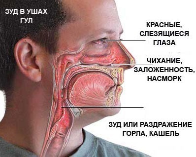 Cum de a elibera alergie de primăvară Krasnoyarsk farmacie online farmlek (pisici de păr Ragweed) Cum de a elibera alergie de primăvară Krasnoyarsk farmlek farmacie online