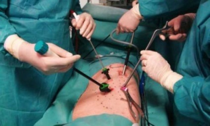 Ceea ce medicul este angajat la nivelul coloanei vertebrale (angajat) Ceea ce medicul este angajat la nivelul coloanei vertebrale