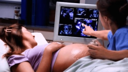 PVE la copii dobândite și tratamentul de picior stramb congenital picior stramb, tencuieli cu (copii) PVE la copii dobândite și tratamentul de picior stramb congenital picior stramb, tencuieli cu