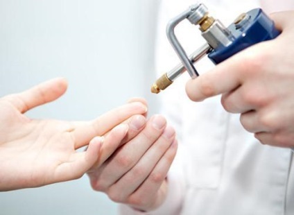 Crioterapia este că un astfel de tratament crioterapia (ajutor azot lichid) Crioterapia este ceea ce este, tratamentul cu crioterapia