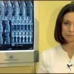 tratament miopie cu exerciții (miopia) Tratamentul cu miopie exercitarea