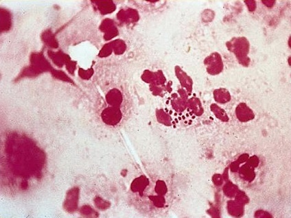 Microscopice frotiu 20 minute cu experienta dermatolog (microscopie decriptare frotiu) microscopic timp de 20 de minute dermatolog experimentat
