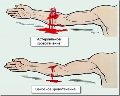 Aplicarea unui bandaj de presiune - studopediya (suprapunere) Aplicarea unui bandaj de presiune - studopediya