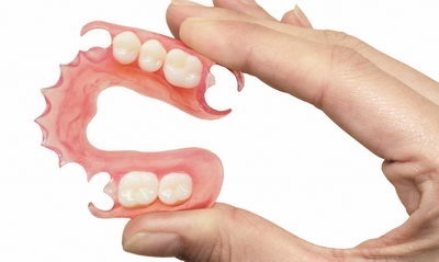 Nylon proteză - funcțională și estetică - despre corecție muscatura si bretele (proteze) Nylon proteză - funcțională și estetică - despre corecția mușcătură și acolade