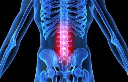 Osteocondrozei a coloanei vertebrale lombare - simptome si tratament (lombare) Osteocondrozei a coloanei vertebrale lombare - simptome și tratament