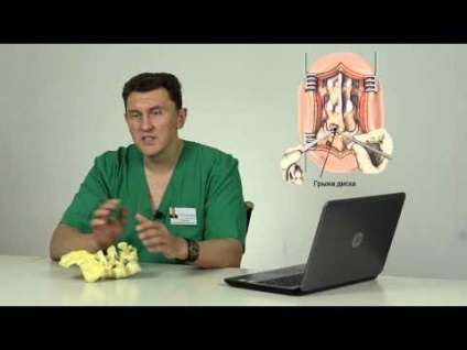 Pareze oprește ceea ce este, de tratament (tratament) Pareze oprește ceea ce este, un tratament