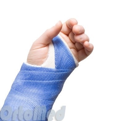 Fractura de arme rază într-un loc tipic, cu o recuperare de fractură fascicul offset (os) Os rupt brațul radial într-un loc tipic, cu o recuperare de fractură fascicul de offset