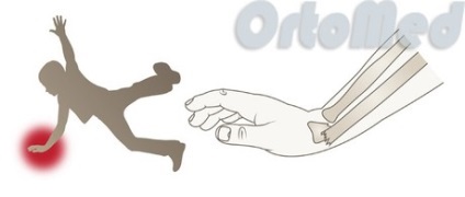 Fractura de arme rază într-un loc tipic, cu o recuperare de fractură fascicul offset (mâini) Os rupt brațul radial într-un loc tipic, cu o recuperare de fractură fascicul de offset