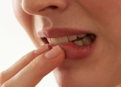 Periodontita, dinte - ceea ce este (dintele) Periodontita, dinte - ceea ce este