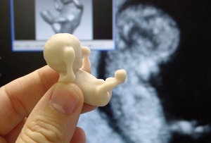 Prima ecografie în timpul sarcinii atunci cand o fac, se arată cum să se pregătească (prima ecografie în timpul sarcinii) Prima ecografie în timpul sarcinii atunci cand o fac, se arată cum să se pregătească
