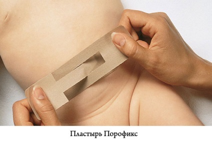 Ipsos din specia ombilicale hernia Baby folosite (nou-născuți) Ipsos de hernie ombilicală Species Baby, modul de utilizare