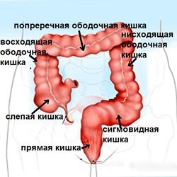 Simptomele de dureri abdominale colite, diaree, tulburări de scaun (tratament) Simptomele de dureri abdominale colita, diaree, tulburări de scaun