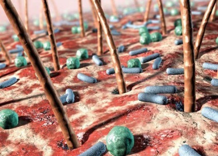 Rolul bacteriilor într-o persoană de viață (bacteriilor nocive de fermentare) Rolul bacteriilor in viata unei persoane