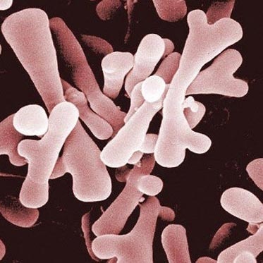 Rolul bacteriilor într-o persoană de viață (bacteriilor nocive de fermentare) Rolul bacteriilor in viata unei persoane
