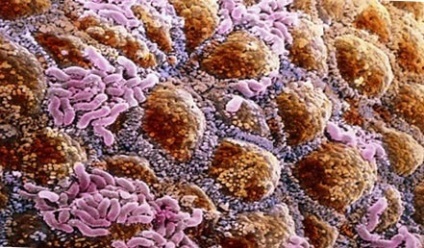 Rolul bacteriilor într-o persoană de viață (bacteriilor nocive de fermentare) Rolul bacteriilor in viata unei persoane