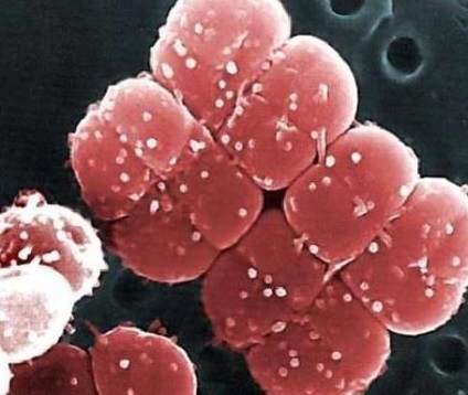 Rolul bacteriilor in viata unei persoane (bacterii) Rolul bacteriilor in viata unei persoane