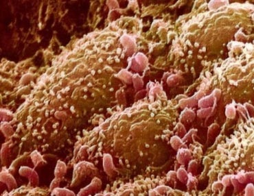Rolul bacteriilor într-o persoană de viață (bacterii stricare) Rolul bacteriilor in viata unei persoane