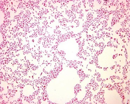 Rolul bacteriilor in viata unei persoane (bacterii) Rolul bacteriilor in viata unei persoane