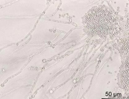 Rolul bacteriilor într-o persoană de viață (bacterii stricare) Rolul bacteriilor in viata unei persoane