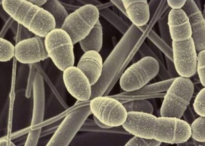 Rolul bacteriilor într-o persoană de viață (bacterii stricare) Rolul bacteriilor in viata unei persoane