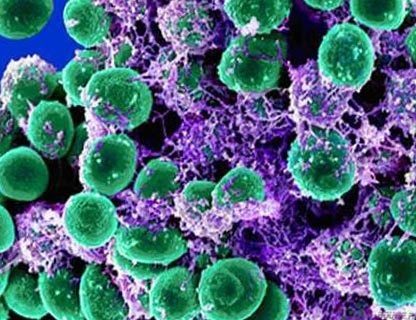 Rolul bacteriilor într-o persoană de viață (bacteriilor nocive de fermentare) Rolul bacteriilor in viata unei persoane