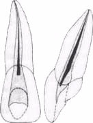 Sky - endodontie clinice (cavitatea dintelui autopsie) Sky - endodonție clinice