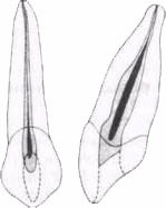 Sky - endodonție clinice (Medie maxilar) Sky - endodonție clinice