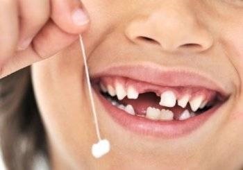 Conditii de dentiției la copii comanda de schimbare, o masă de grafică, precum și (molari erup de temperatură) aferente Conditii de dentiției la copii comanda de schimbare, o masă de grafică, precum și conexe