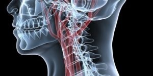 Vasoconstricție tratamentului coloanei vertebrale cervicale (îngustarea) vasoconstricție tratamentului coloanei vertebrale cervicale