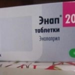vasoconstricție tratamentului coloanei vertebrale cervicale (de col uterin) vasoconstricție tratamentului coloanei vertebrale cervicale