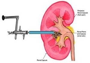 Departamentul de Urologie, MBU - Spitalul Orășenesc №1 (Spitalul) Urologie Departamentul, MBU - Spitalul Orășenesc №1