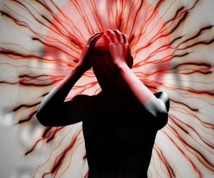 Tipuri de accident vascular cerebral creierului și diferența lor (creier) Tipuri de accident vascular cerebral cerebrale și diferențele lor