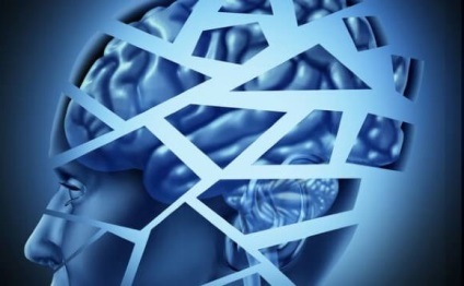 Tipuri de accident vascular cerebral cerebrale și diferențele (diferențe) Tipuri de accident vascular cerebral cerebrale și diferențele lor