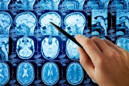 Simptome intracraniene presiune și tratament la adulți, metode de diagnostic și tratament