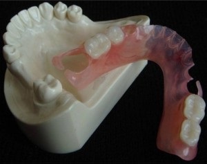proteze dentare nylon (nylon) Nylon protetică dentară