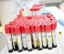 Testosteronul la barbati (testosteron) Testosteronul la barbati