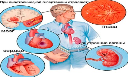 Arată că scăderea tensiunii arteriale, și ceea ce ar trebui să fie de care depinde (sânge) Ce face tensiunii arteriale mai mici, ceea ce ar trebui să fie și ce depinde