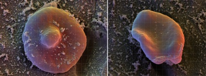 Ce este malaria (infecția cu Plasmodium vivax) Ce este malaria