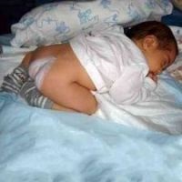 Dermatita la copii (dermatită) Dermatita la copii