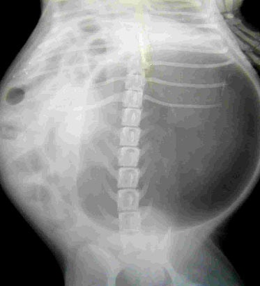 Etiologia volvulus gastric la câini (poziția anatomică) Etiologia volvulus gastric la câini