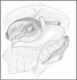 Etiologia volvulus gastric la câini (poziția anatomică) Etiologia volvulus gastric la câini