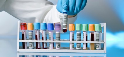 Enzyme insuficiență pancreatică - tratament și simptome (insuficiență) Enzyme insuficiență pancreatică - Tratamentul si Simptome