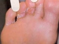 Fonoforeza în cosmetologie și ginecologice indicații, contraindicații, comentarii (mărturii) Fonoforeza în cosmetologie și ginecologice indicații, contraindicații, comentarii